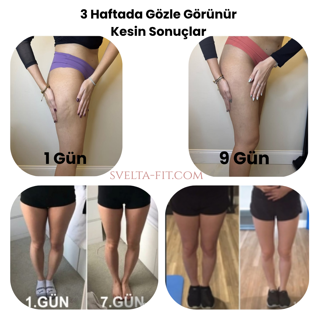 Svelta-Fit Bacak İncelten  Masaj Aleti